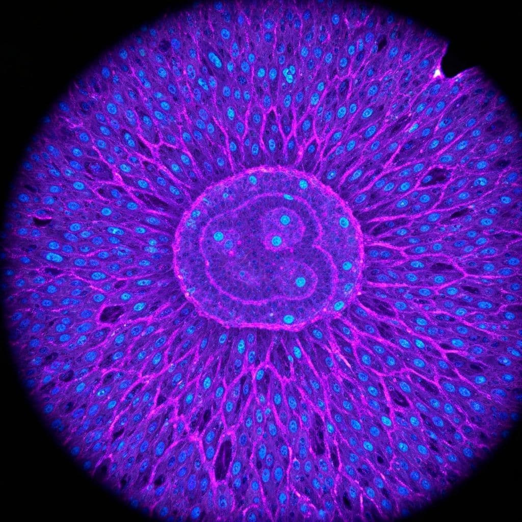 Tumor Immunology Lab